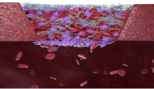 control bleeding transfuse immediately